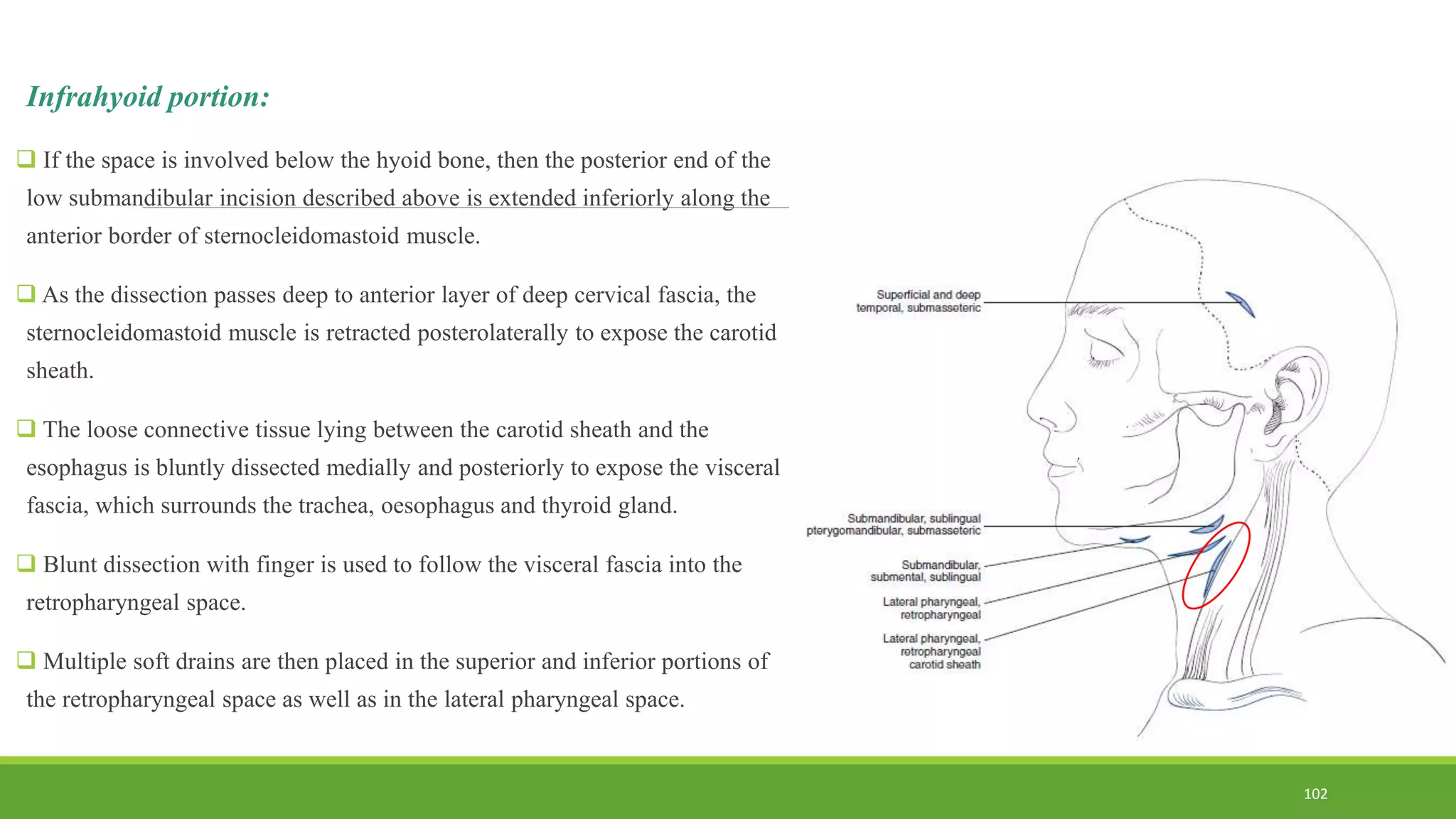 Infrahyoid portion:
 If the space is involved below the hyoid bone, then the posterior end of the
low submandibular incision described above is extended inferiorly along the
anterior border of sternocleidomastoid muscle.
 As the dissection passes deep to anterior layer of deep cervical fascia, the
sternocleidomastoid muscle is retracted posterolaterally to expose the carotid
sheath.
 The loose connective tissue lying between the carotid sheath and the
esophagus is bluntly dissected medially and posteriorly to expose the visceral
fascia, which surrounds the trachea, oesophagus and thyroid gland.
 Blunt dissection with finger is used to follow the visceral fascia into the
retropharyngeal space.
 Multiple soft drains are then placed in the superior and inferior portions of
the retropharyngeal space as well as in the lateral pharyngeal space.
102
 