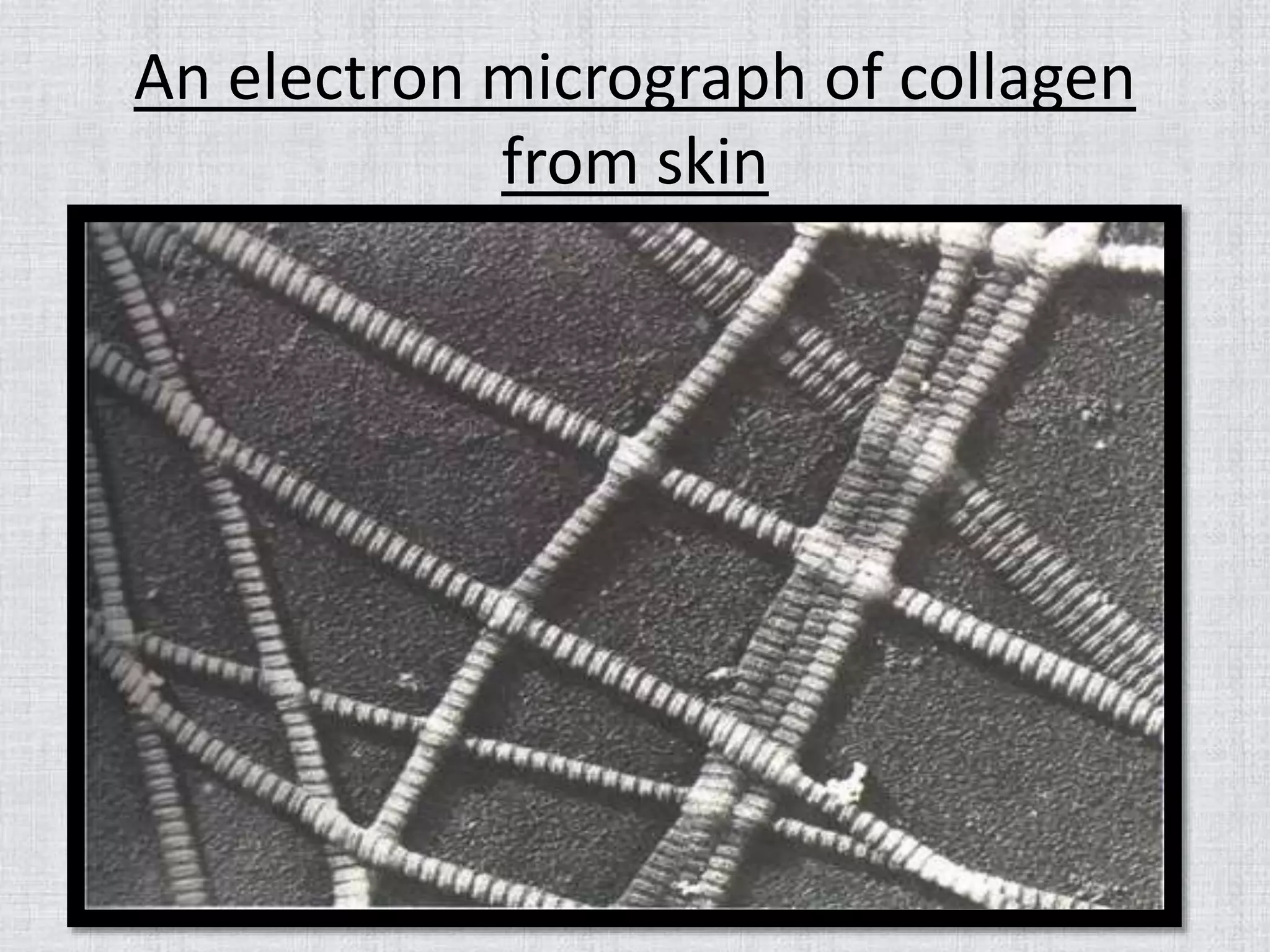An electron micrograph of collagen
from skin
 