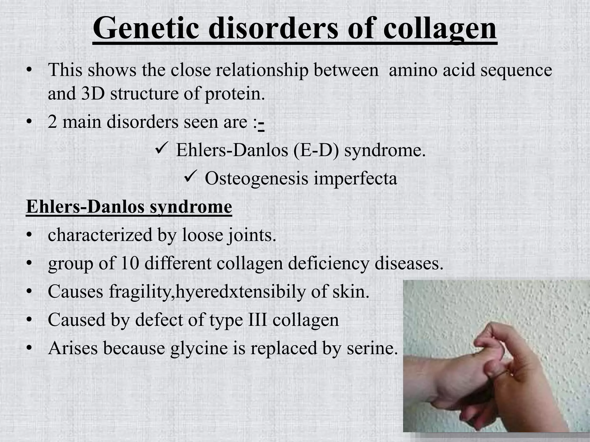 Genetic disorders of collagen
• This shows the close relationship between amino acid sequence
and 3D structure of protein.
• 2 main disorders seen are :-
 Ehlers-Danlos (E-D) syndrome.
 Osteogenesis imperfecta
Ehlers-Danlos syndrome
• characterized by loose joints.
• group of 10 different collagen deficiency diseases.
• Causes fragility,hyeredxtensibily of skin.
• Caused by defect of type III collagen
• Arises because glycine is replaced by serine.
 