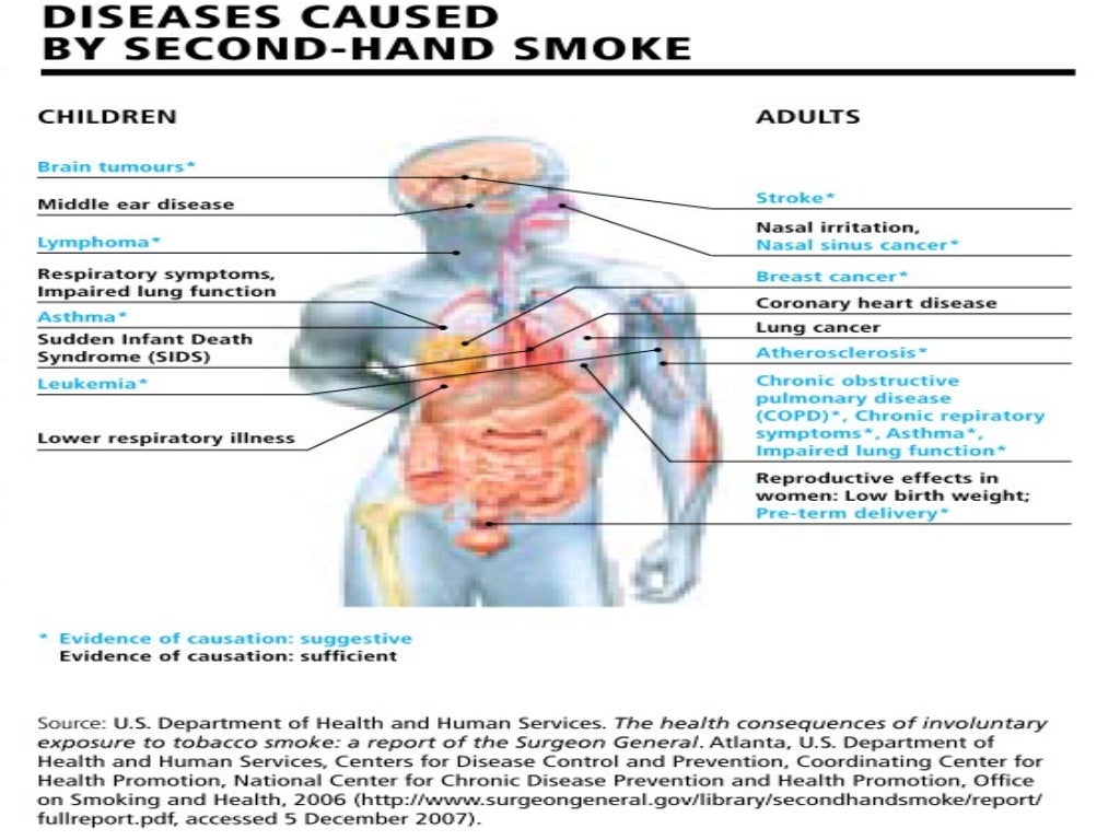 Second hand smoke