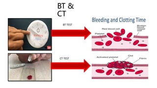 BT &
CT
BT TEST
CT TEST
 