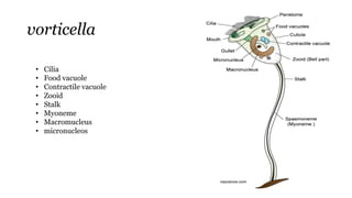 vorticella
• Cilia
• Food vacuole
• Contractile vacuole
• Zooid
• Stalk
• Myoneme
• Macromucleus
• micronucleos
 