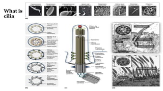 What is
cilia
 
