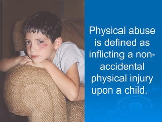 Physical abuse
  is defined as
inflicting a non-
    accidental
 physical injury
 upon a child.
 