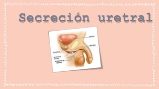 Secreción uretral
 