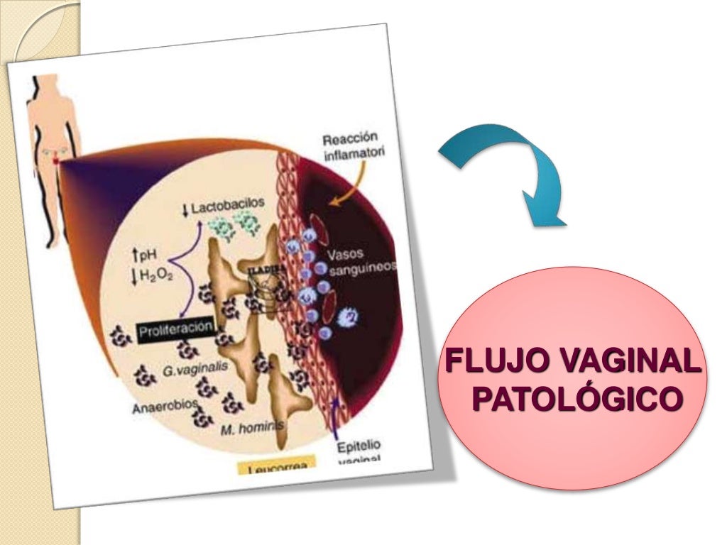 Secrecion vaginal flujo vaginal expo