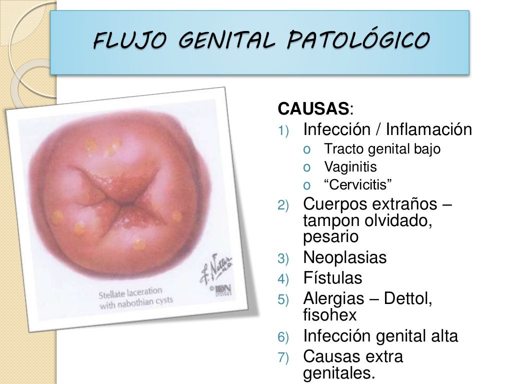 Secrecion vaginal flujo vaginal expo