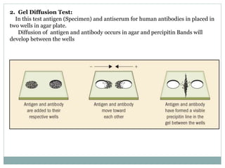 2. Gel Diffusion Test:
In this test antigen (Specimen) and antiserum for human antibodies in placed in
two wells in agar plate.
Diffusion of antigen and antibody occurs in agar and percipitin Bands will
develop between the wells
 