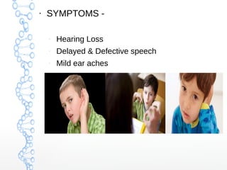 ●

SYMPTOMS –

Hearing Loss

–

Delayed & Defective speech

–

Mild ear aches

 