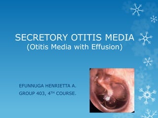 SECRETORY OTITIS MEDIA
(Otitis Media with Effusion)
EFUNNUGA HENRIETTA A.
GROUP 403, 4TH COURSE.
 