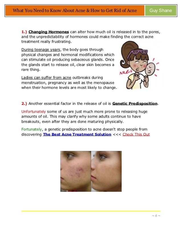 Secrets To Get Rid Of Acne Fast