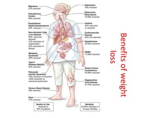 Benefits
of
weight
loss
 