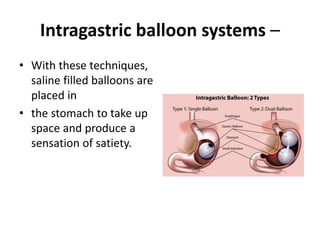 Intragastric balloon systems –
• With these techniques,
saline filled balloons are
placed in
• the stomach to take up
space and produce a
sensation of satiety.
 