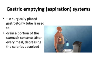 Gastric emptying (aspiration) systems
• – A surgically placed
gastrostomy tube is used
to
• drain a portion of the
stomach contents after
every meal, decreasing
the calories absorbed
 