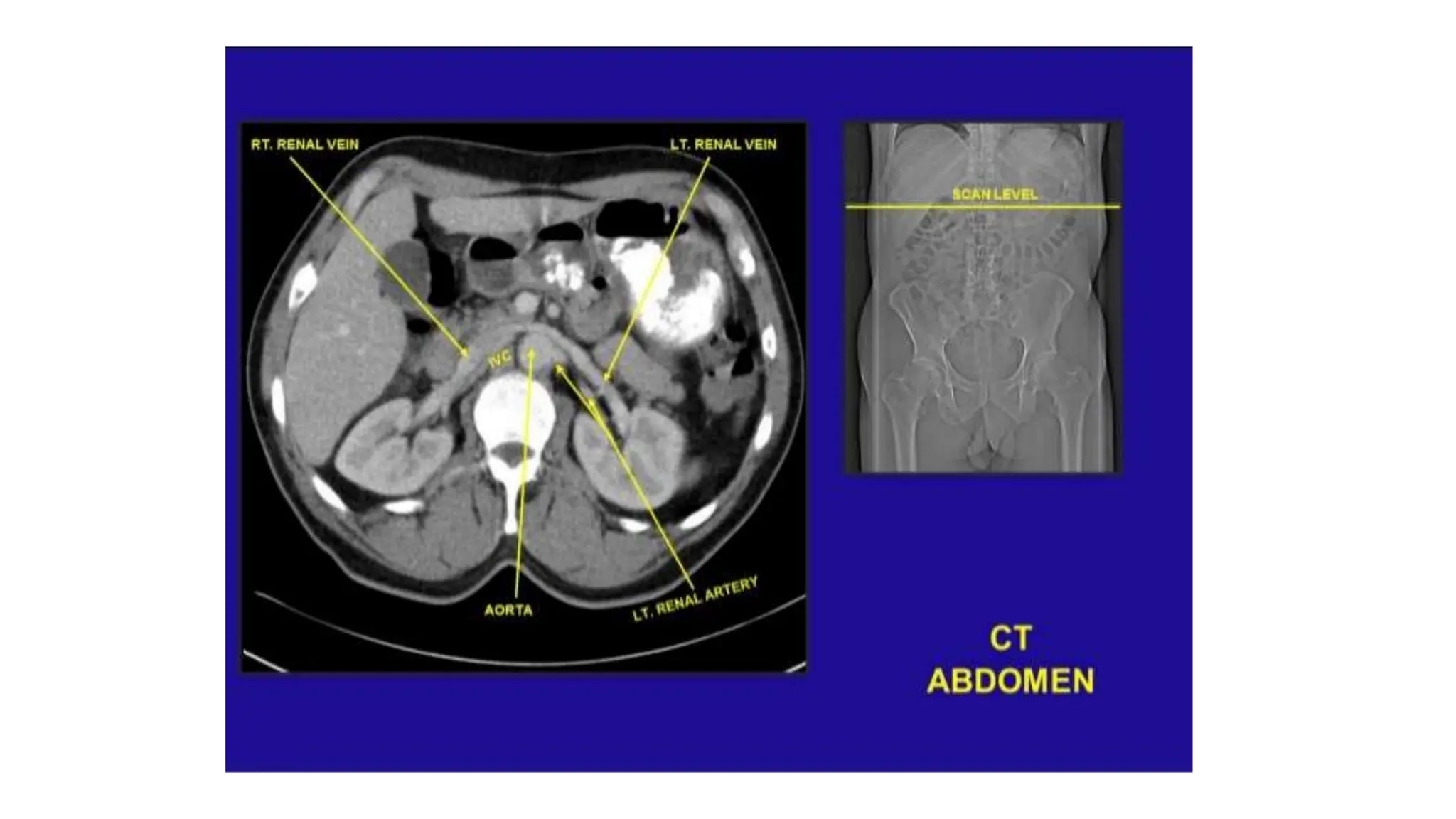 Section 1 CT Abdomen and Pelvis by doctor Aya Ali Taha | PPTX