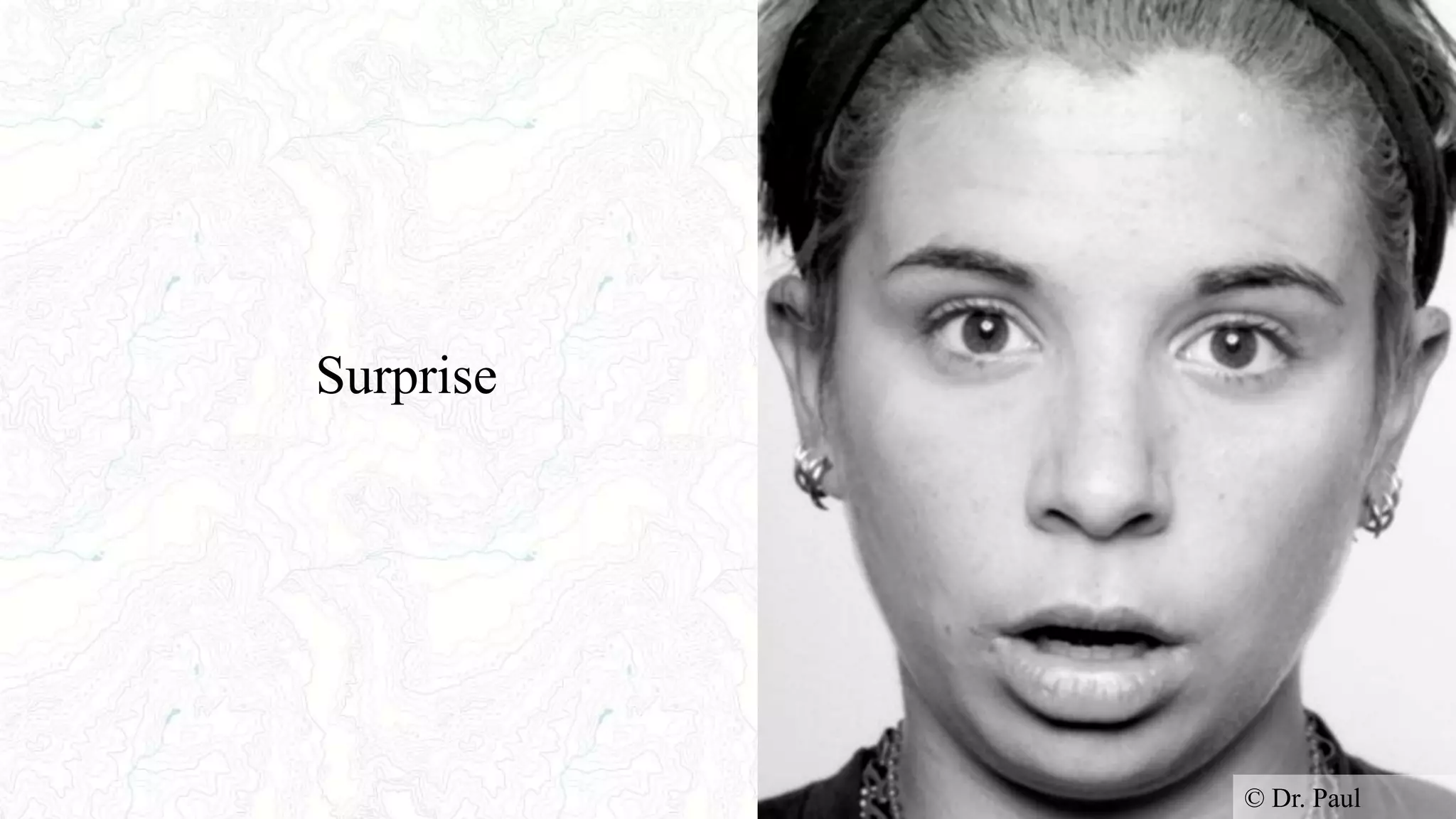 Surprise
© Dr. Paul
 