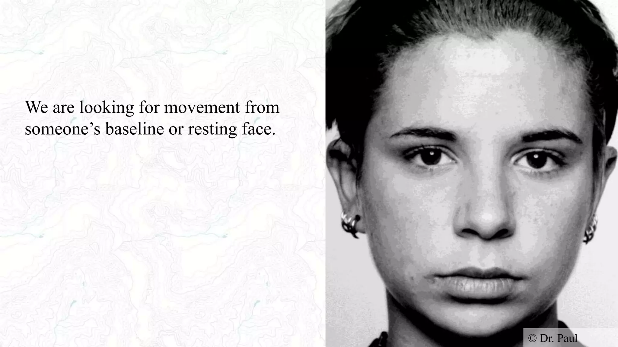 We are looking for movement from
someone’s baseline or resting face.
© Dr. Paul
 