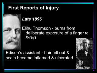 First Reports of Injury

        Late 1896

        Elihu Thomson - burns from
          deliberate exposure of a finger to
          X-rays



Edison’s assistant - hair fell out &
scalp became inflamed & ulcerated
 