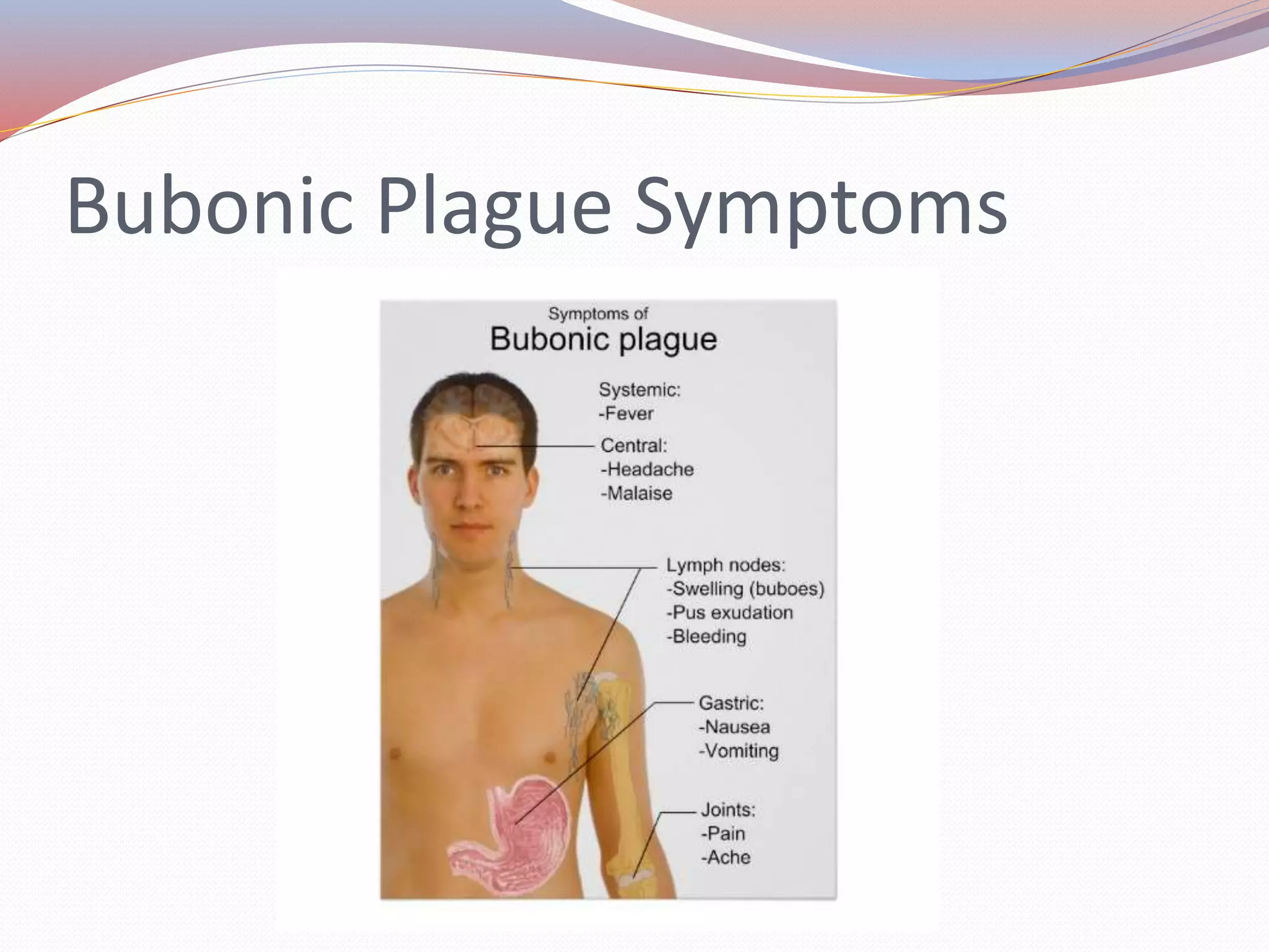 Bubonic Plague Symptoms
 