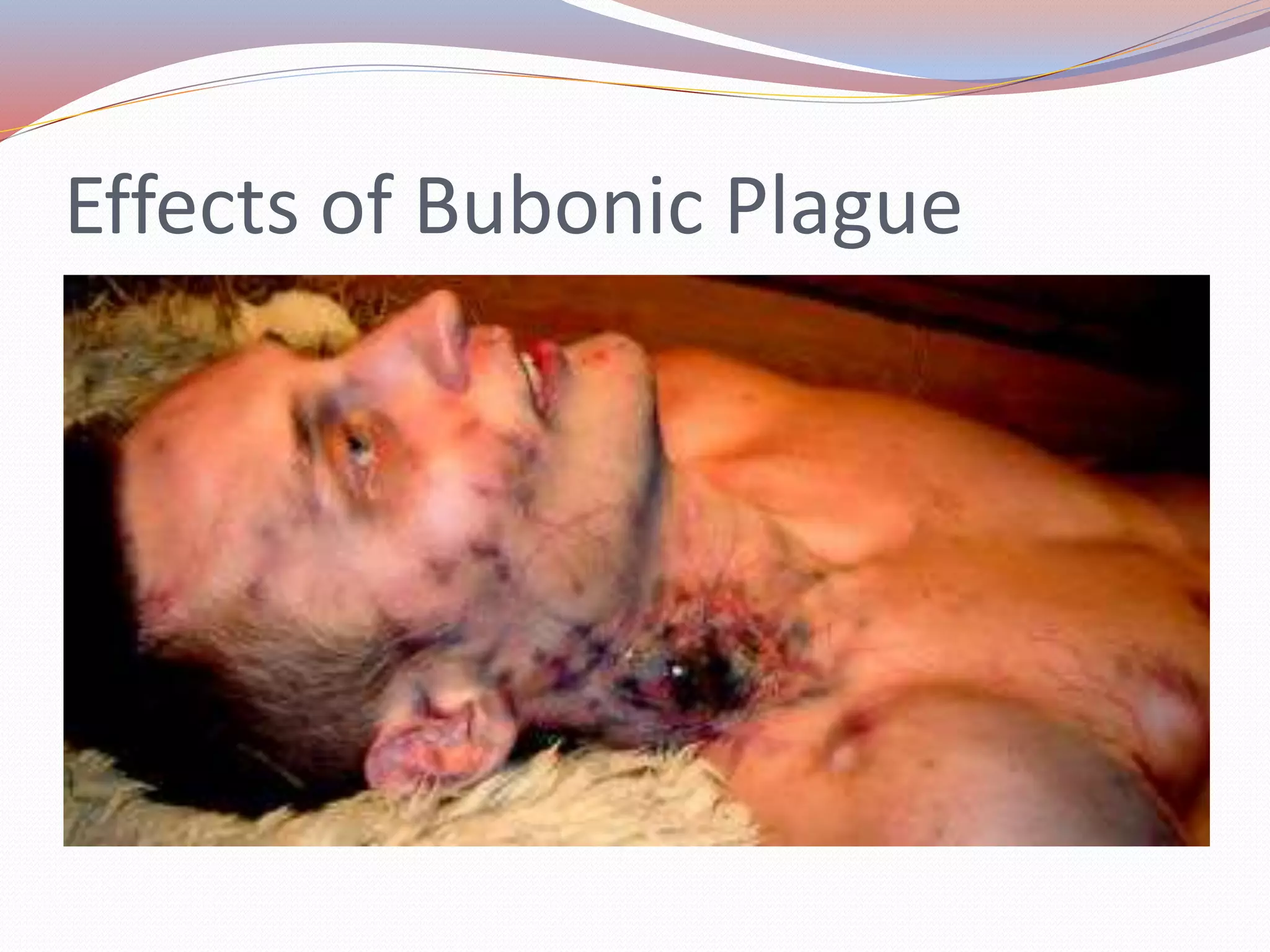 Effects of Bubonic Plague
 