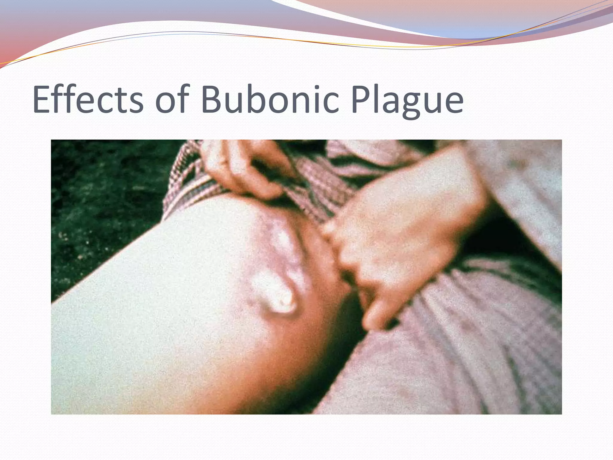 Effects of Bubonic Plague
 