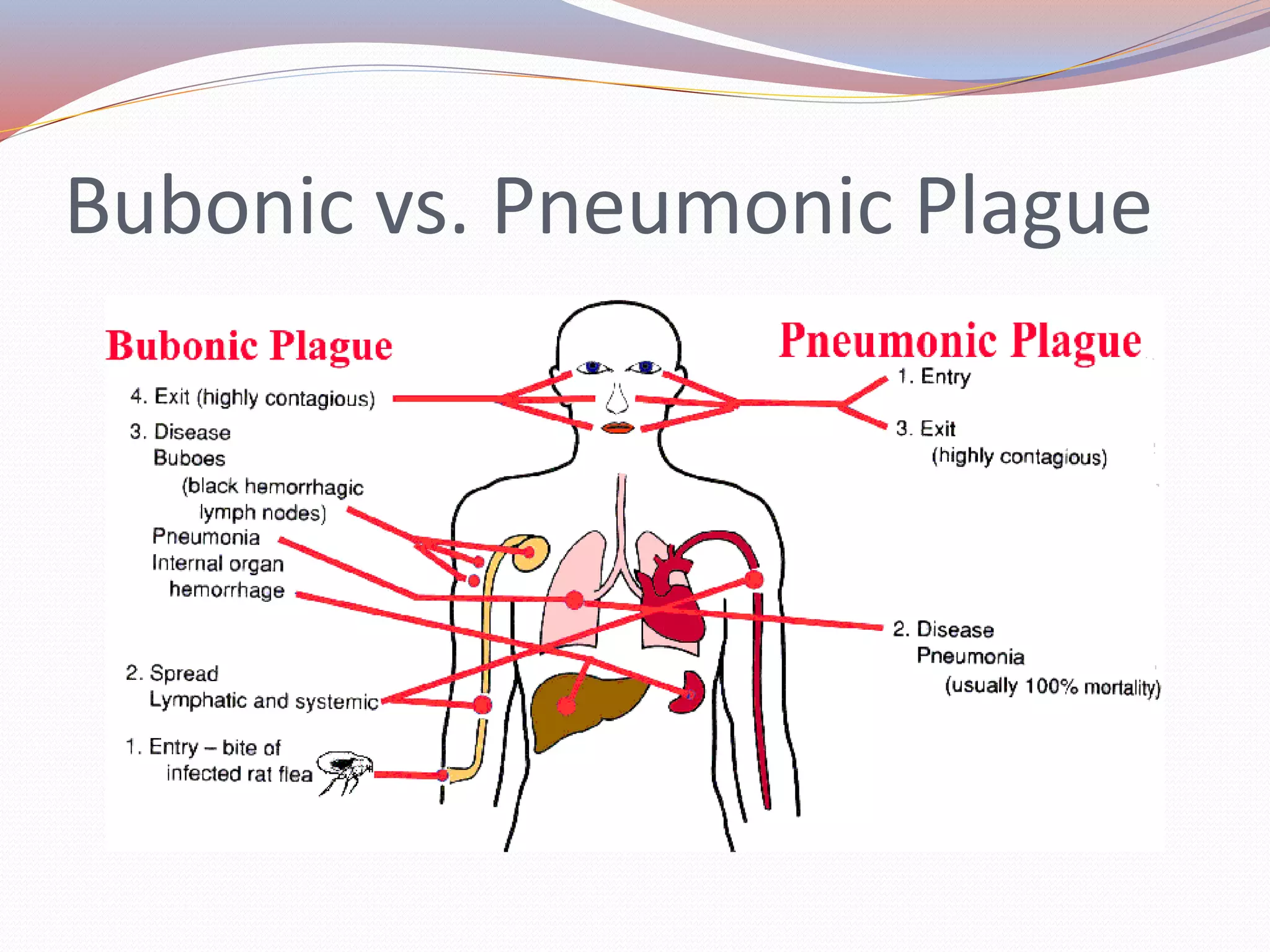 Bubonic vs. Pneumonic Plague
 