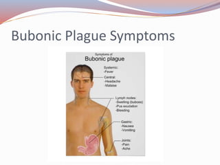 Bubonic Plague Symptoms
 