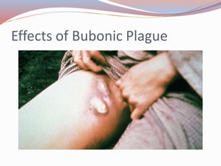 Effects of Bubonic Plague
 