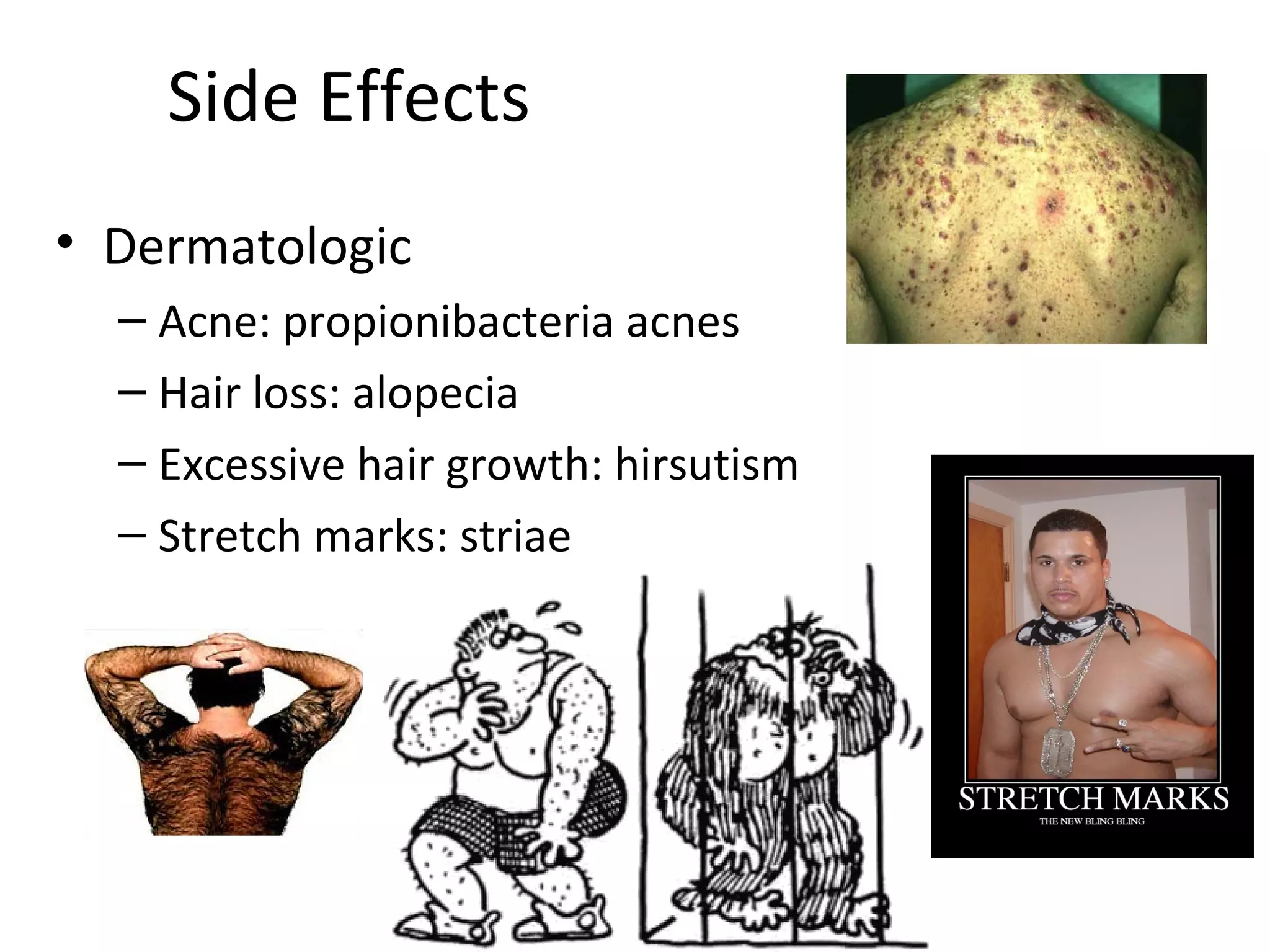 Side Effects
• Dermatologic
  – Acne: propionibacteria acnes
  – Hair loss: alopecia
  – Excessive hair growth: hirsutism
  – Stretch marks: striae
 
