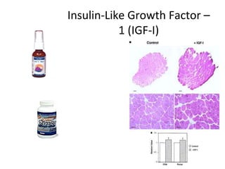 Insulin-Like Growth Factor –
           1 (IGF-I)
 