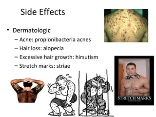 Side Effects
• Dermatologic
  – Acne: propionibacteria acnes
  – Hair loss: alopecia
  – Excessive hair growth: hirsutism
  – Stretch marks: striae
 