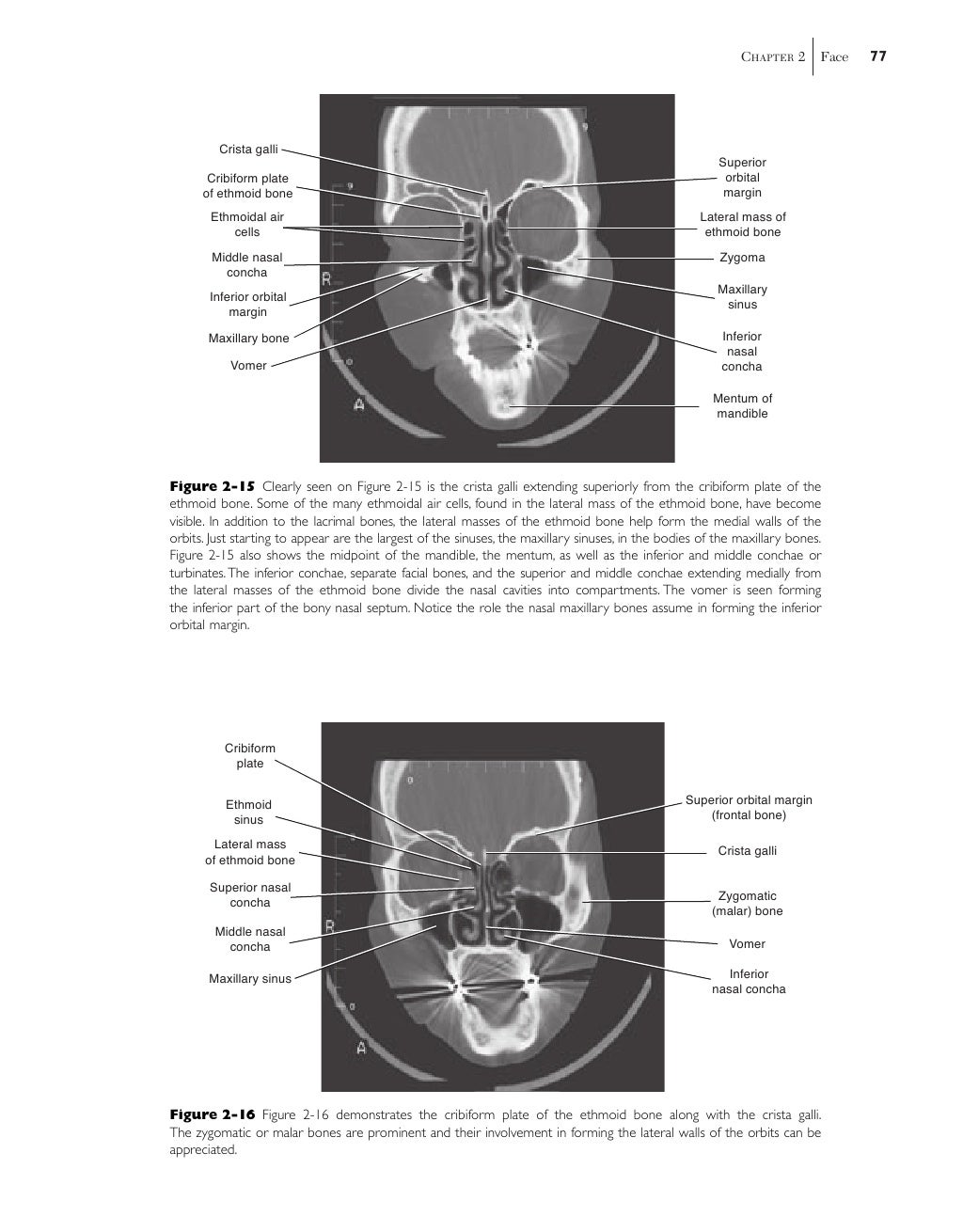 Sectional anatomy Biology Diagrams