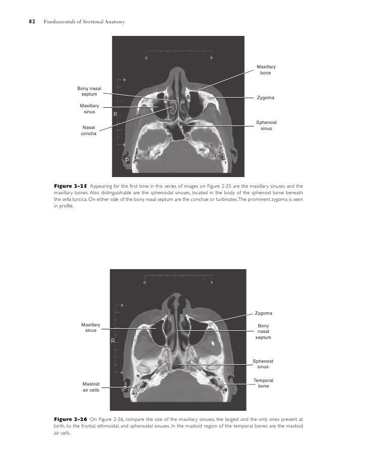 Sectional anatomy