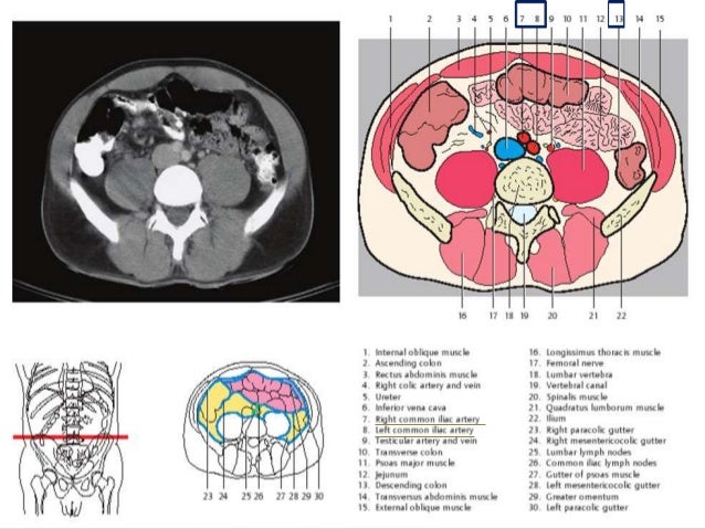 Sectional anatomy of abdomen