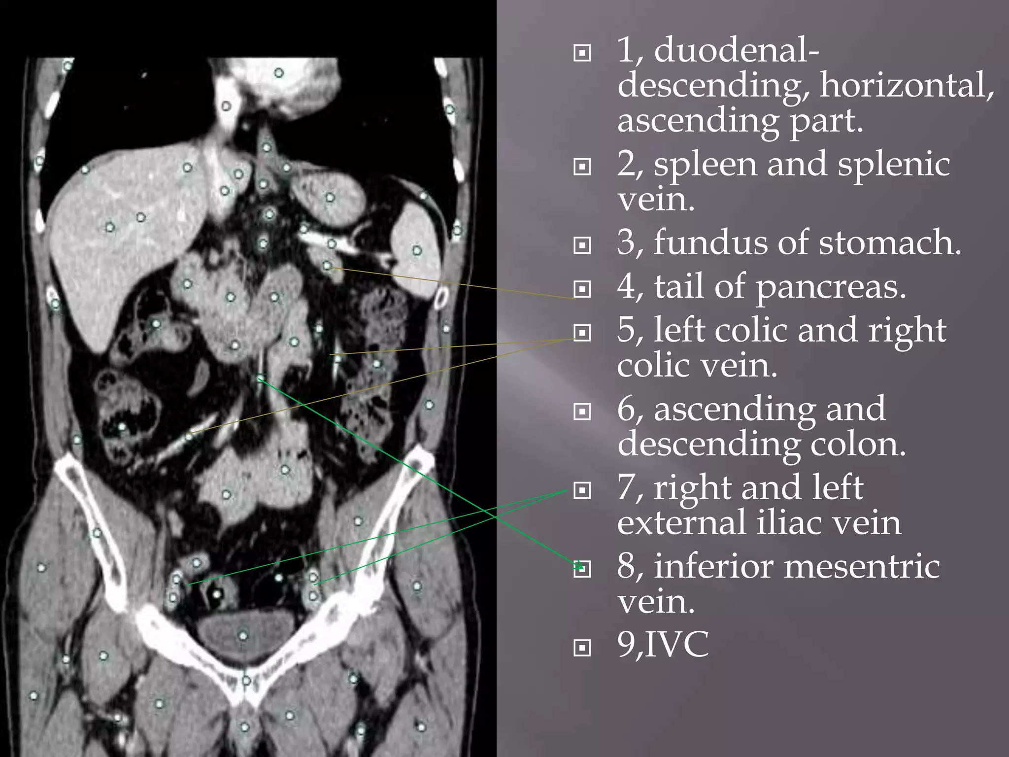 Sectional radio-anatomy of abdomen | PPTX