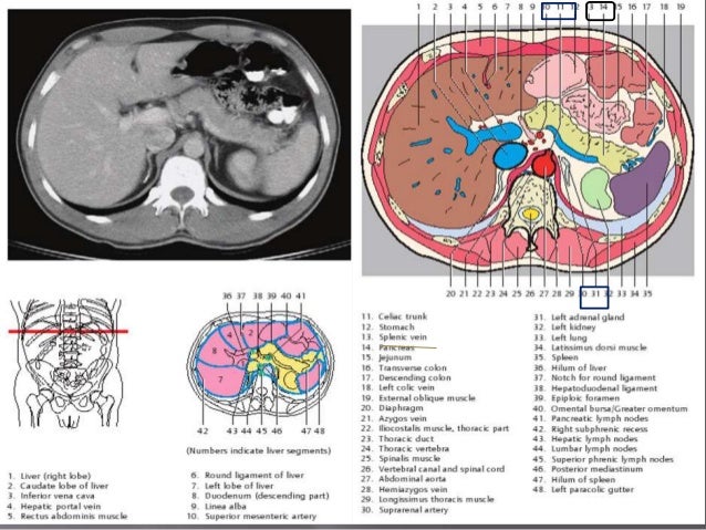 Sectional radio-anatomy of abdomen colon wall diagram 