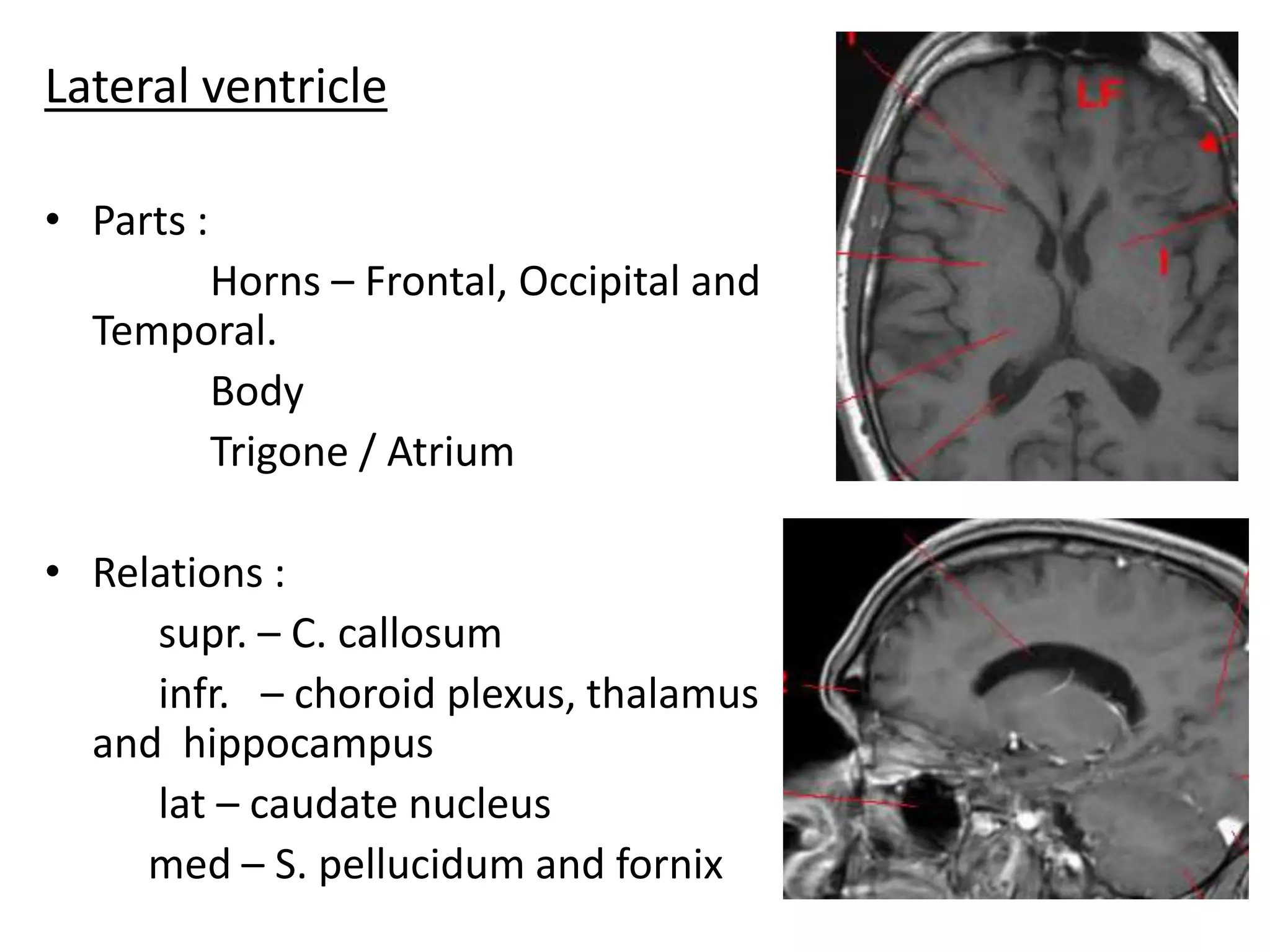Lateral ventricle

• Parts :
       Horns – Frontal, Occipital and
  Temporal.
       Body
       Trigone / Atrium

• Relations :
     supr. – C. callosum
     infr. – choroid plexus, thalamus
  and hippocampus
     lat – caudate nucleus
     med – S. pellucidum and fornix
 