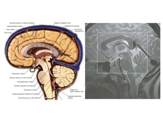Imaging sectional anatomy of brain part 1 | PPTX