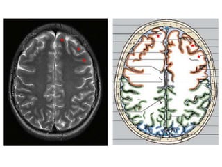 Imaging sectional anatomy of brain part 1 | PPTX
