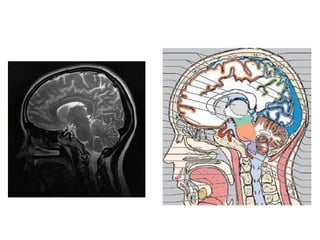 Imaging sectional anatomy of brain part 1 | PPTX
