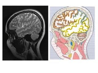 Imaging sectional anatomy of brain part 1 | PPTX