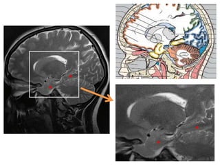 Imaging sectional anatomy of brain part 1 | PPTX