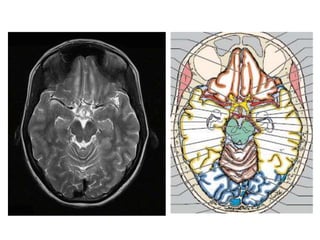 Imaging sectional anatomy of brain part 1 | PPTX