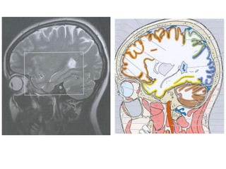 Imaging sectional anatomy of brain part 1 | PPTX