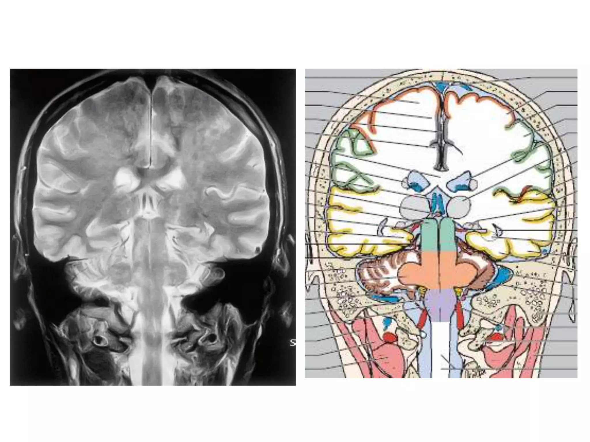 Sectional anatomy of brain part 1 | PPTX