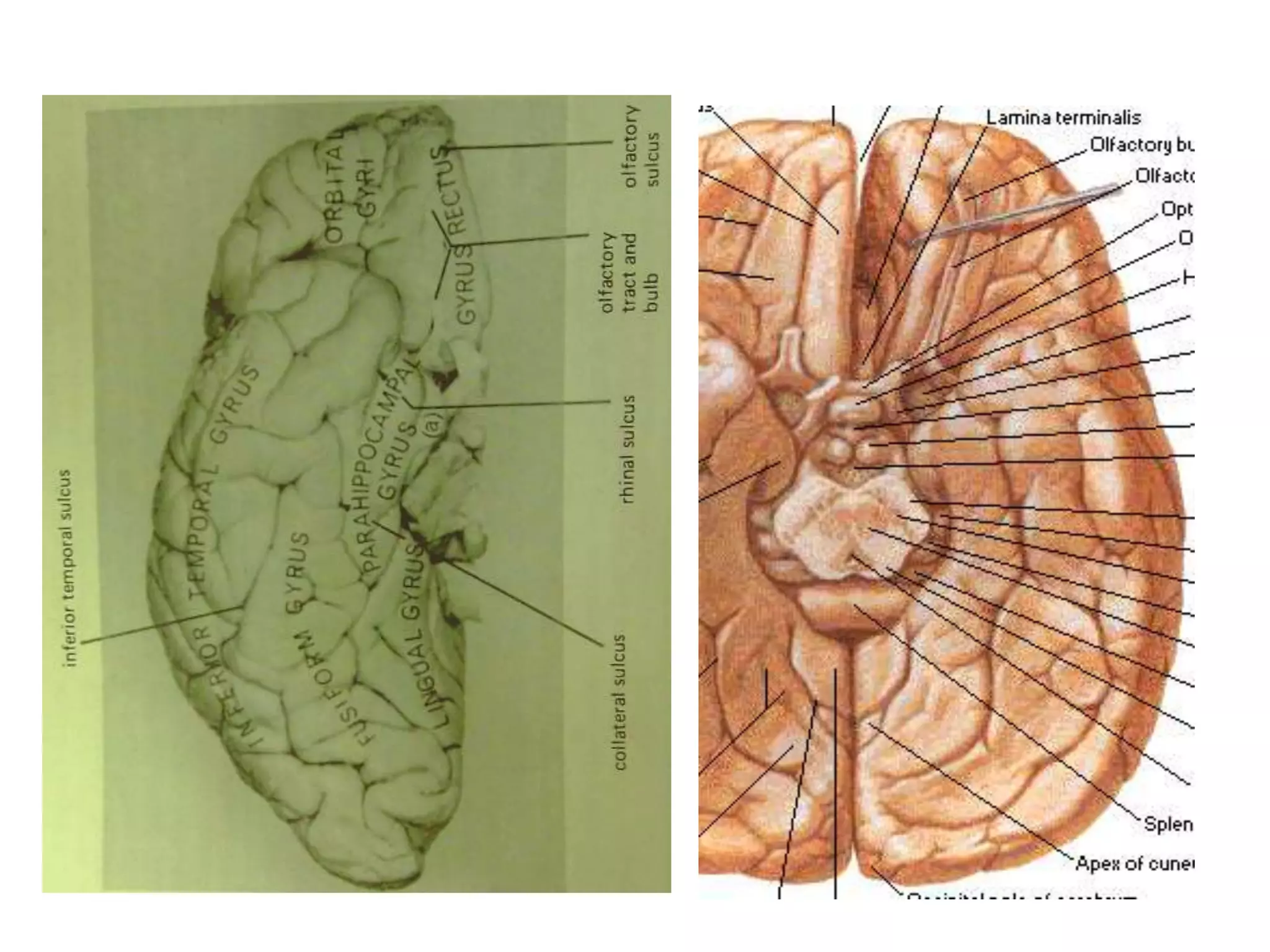 Sectional anatomy of brain part 1 | PPTX