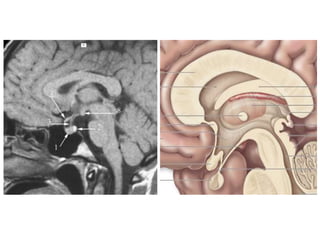 Sectional anatomy of brain part 1 | PPTX