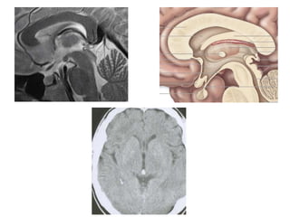 Sectional anatomy of brain part 1 | PPTX