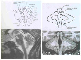 Sectional anatomy of brain part 1 | PPTX