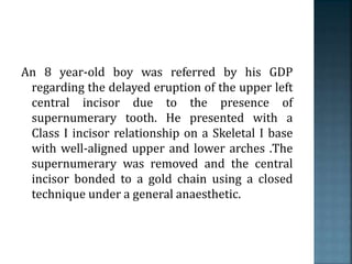 An 8 year-old boy was referred by his GDP
regarding the delayed eruption of the upper left
central incisor due to the presence of
supernumerary tooth. He presented with a
Class I incisor relationship on a Skeletal I base
with well-aligned upper and lower arches .The
supernumerary was removed and the central
incisor bonded to a gold chain using a closed
technique under a general anaesthetic.
 